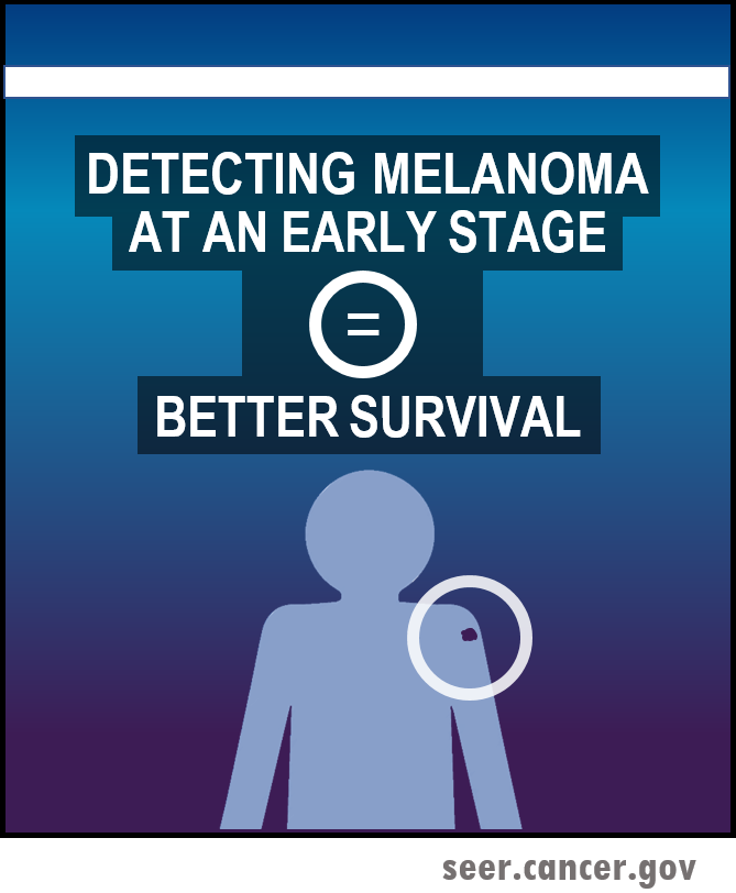 detecting melanoma in earlier stage leads to better survival