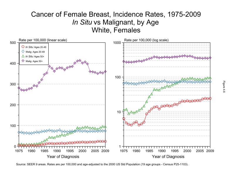 CSR Figure 4.6: SEER Incidence Rates, In Situ vs Malignant, White