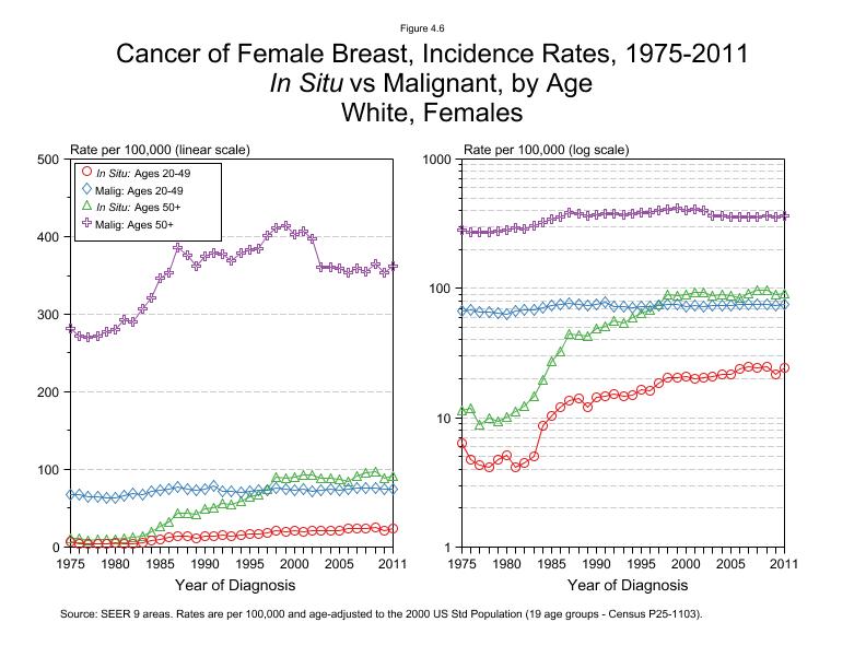 CSR Figure 4.6: SEER Incidence Rates, In Situ vs Malignant, White