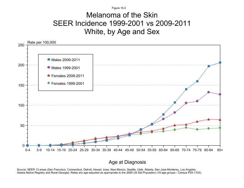 CSR Figure 16.3: SEER Incidence by Age and Sex