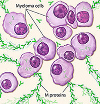 Illustration of myeloma cells.