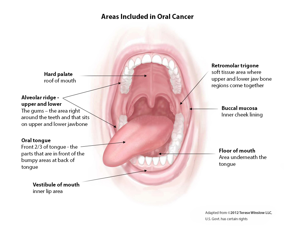 Diagram of an open mouth showing the different areas included in oral cancer.